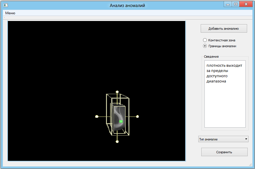 Анализ аномалий